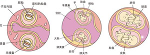 女婴扎针下胎生男_印度一女婴体内有8个寄生胎_寄生胎图片
