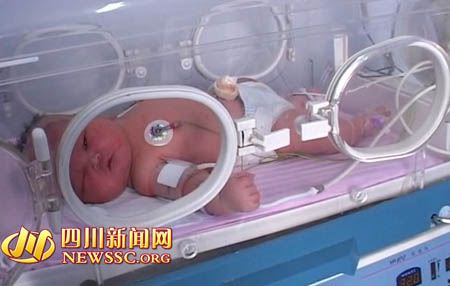  孕妇产12.5斤巨婴 ,占满保育箱