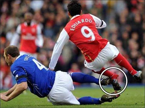 足坛10大断腿:天才双腿惨尽废